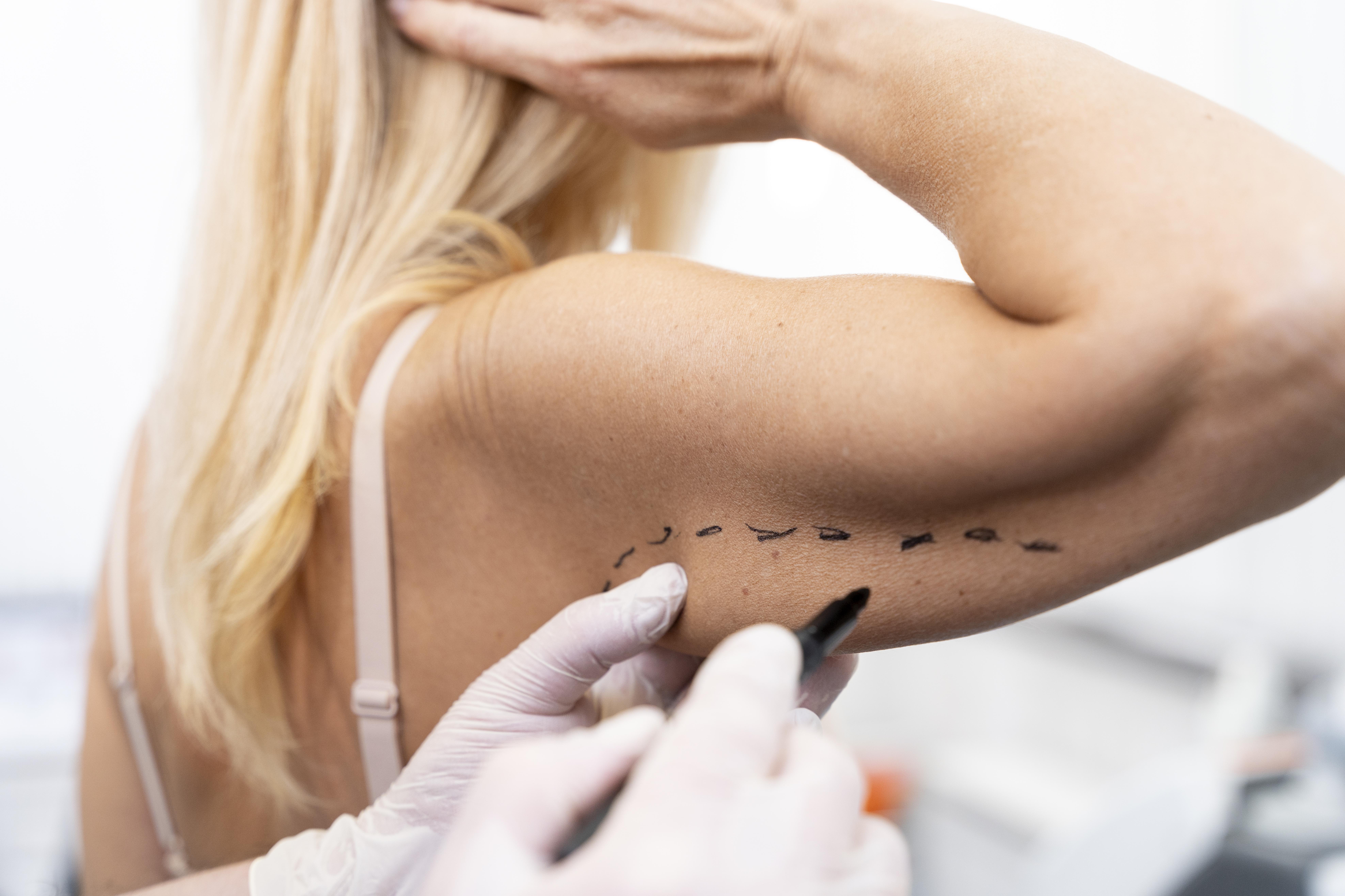 Yuzda Estetik Protseduralar Va Plastik Xirurgiya